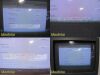 PHILIPS HD11 Ultrasound System W/ L12-5 Linear Array & C5-2 Convex Probe