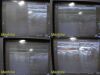 PHILIPS HD11 Ultrasound System W/ L12-5 Linear Array & C5-2 Convex Probe