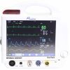 PACE TECH MINIMAX 4000VET Multiparameter Monitor