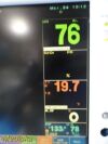 FUKUDA DENSHI DS-7200 Series Dynascape Monitor