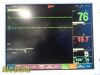 FUKUDA DENSHI DS-7200 Series Dynascape Monitor