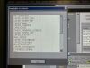 SIEMENS Biograph 6 PET/CT