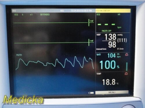 DATASCOPE Trio Colored Patient Monitor