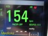 DATASCOPE Trio P/N 0998-00-0600-4009A Monitor