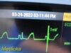 DATASCOPE Trio P/N 0998-00-0600-4009A Monitor