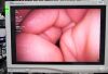 OLYMPUS CYF-VH Cystoscope