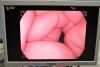 PENTAX EC-3890LK Colonoscope