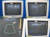 SIEMENS 2007  Sonoline G40 Diagnostic Ultrasound System W/ EC9-4 Endo Probe