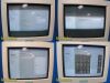 SIEMENS 2007  Sonoline G40 Diagnostic Ultrasound System W/ EC9-4 Endo Probe