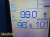 WELCH ALLYN Hill Rom W.A 45NT0 Spot Vital Signs LXI Monitor
