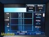 PHILIPS 2013  Novametrix NM3 Respiratory Profile Monitor