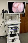 OLYMPUS Exera III 190 Series Endoscopy System