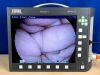 KARL STORZ Telepack X 20045020 with head and footswitch Laparoscope