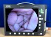 KARL STORZ Telepack X 20045020 with head and footswitch Laparoscope