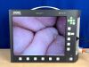 KARL STORZ Telepack X 20045020 with head and footswitch Laparoscope