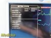GE Dash 3000 Multi-parameter Patient Monitor