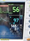 GE Dash 3000 Multi-parameter Patient Monitor