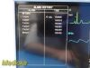 GE Healthcare Dash 3000 Patient Monitor