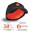 HAIRSMART 272 Laser Cap
