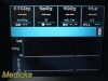 PHILIPS 2014  Novametrix NM3 Respiratory Profile Monitor