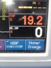 FUKUDA DENSHI 2014  DS-7100,W/ NEW LEADS (CO2,IBP,NBP,ECG,TEMP,PRI)~ Monitor