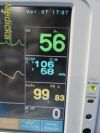 FUKUDA DENSHI 2010  DS-7100 (NBP,IBP,SpO2,ECG,TEMP,Print) Monitor