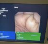 OLYMPUS GIF-XP160 Gastroscope