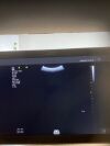 SIEMENS Juniper Ultrasound - OB / GYN