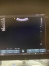 SIEMENS NX2 Ultrasound - OB / GYN