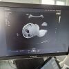 SAMSUNG HS 60 Ultrasound - OB / GYN - Vascular
