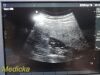 SONOSITE Micromaxx C60e/5-2Mhz Convex Array Ultrasound Transducer