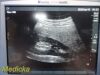 SONOSITE Micromaxx C60e/5-2Mhz Convex Array Ultrasound Transducer