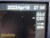SONOSITE Micromaxx C60e/5-2Mhz Convex Array Ultrasound Transducer