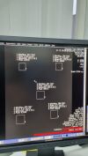 SIEMENS 10501285
10860850 Anrad LMAM1 Detector Mammo Unit