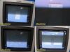 PHILIPS HD11 Diagnostic Ultrasound System