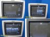 PHILIPS HD11 Diagnostic Ultrasound System
