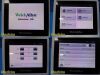 WELCH ALLYN Hill Rom  RetinaVue 100 Imager Fundus Camera W/ Dock,Accesories