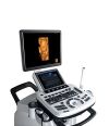 ZONCARE N7 Portable Doppler Ultrasound System