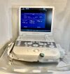 SIEMENS Accuson P300 Esaote Acuson P300 Ultrasound System 2012