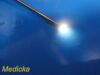 STRYKER 502-427-030 Rigid Telescope, 4mm x 30°, Video Endoscope