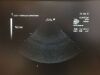 ACUSON 7V3c  Ultrasound Transducer
