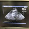 ACUSON 5V2c Ultrasound Transducer