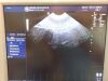 GE 4DE7C Endocavity Ultrasound Transducer Probe Ultrasound - OB / GYN - Vascular