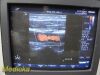 PHILIPS L15-7io Linear Array Intraoperative Hockey Ultrasound Transducer