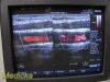 PHILIPS L15-7io Linear Array Intraoperative Hockey Ultrasound Transducer