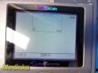 2014 MCube Technology BioCon-500 Cube Scan Bladder Scanner Probe