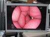 FUJINON EG-600WR Gastroscope