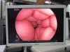 FUJINON EC-600WI Colonoscope