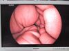 FUJINON EG-450CT5 Gastroscope