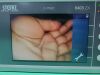KARL STORZ Video Intubation Scope 11303-BNX Laryngoscope